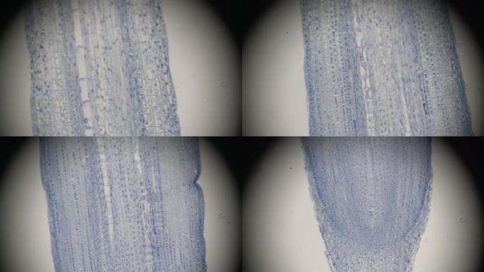 Zea根，Tip l.s。在光学显微镜下