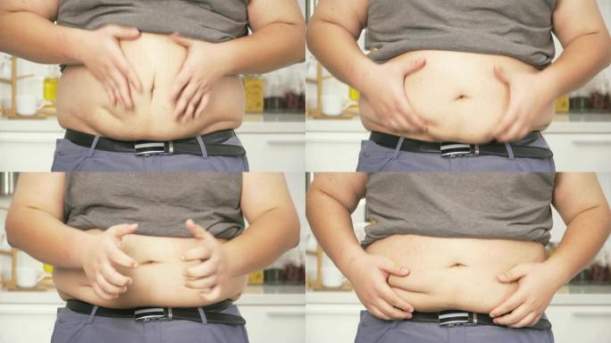 特写镜头: 泰国超重男子的肚子在大肚子上感到焦虑