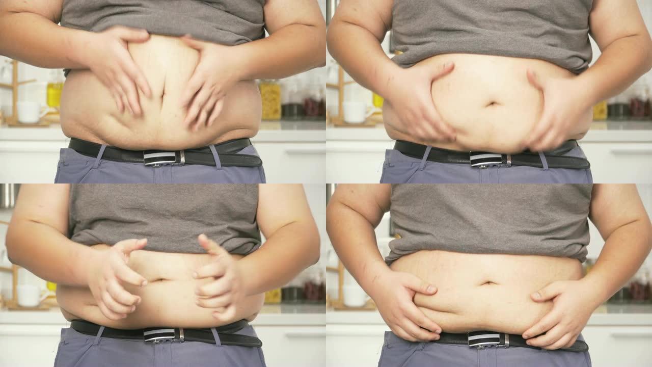 特写镜头: 泰国超重男子的肚子在大肚子上感到焦虑