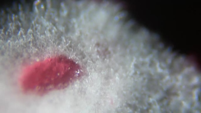 从腐烂的醋栗中取出的霉菌，在显微镜下。浆果果酱上带有孢子的霉菌菌落。过敏，中毒，真菌。白色霉菌菌落的