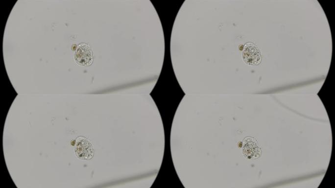 显微镜下睾丸变形虫的排便，内吞 (排泄)