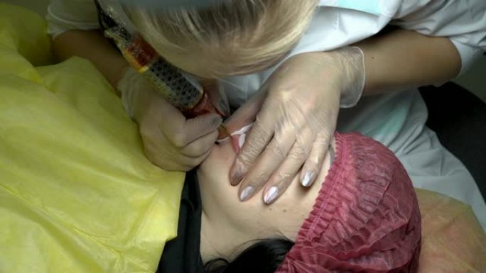 在美容院，一个女人做下唇的纹身。专业美容师用针将颜料涂在女人的嘴唇上。