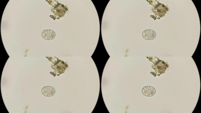 显微镜下的鸡蛋Tardigrada