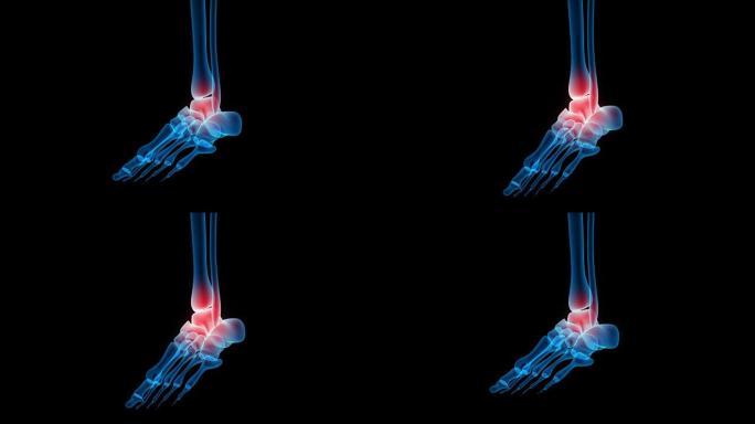 人体骨关节疼痛解剖