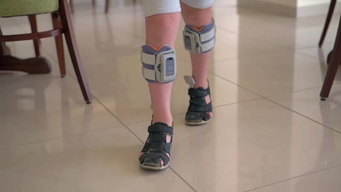 功能性电刺激疗法。儿童穿脚下降系统
