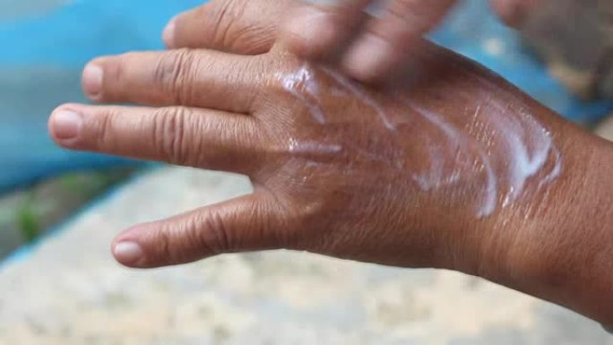 年轻女子手上涂面霜，用于治疗牛皮癣，湿疹和其他干燥皮肤状况的干燥片状皮肤