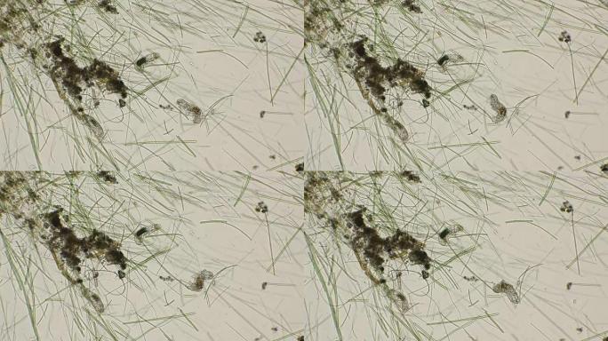 三只水熊Tardigrada，在显微镜下