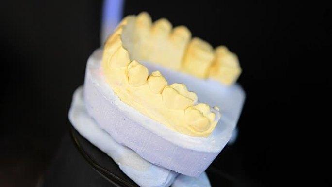 3D扫描人体牙齿特写模型