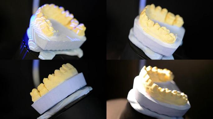3D扫描人体牙齿特写模型