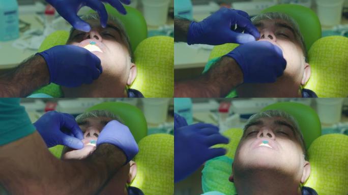 牙齿修复中心的牙齿模型创建。牙齿铸造