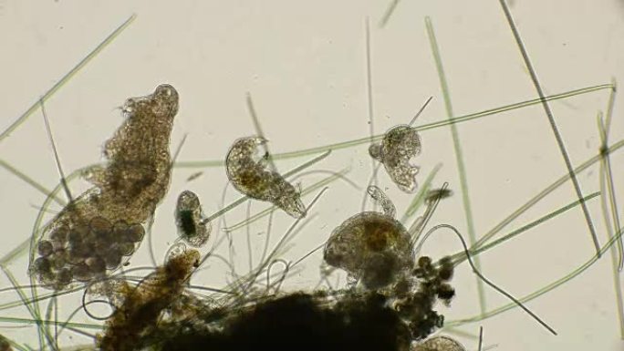 在显微镜下，大型的水熊Tardigrada