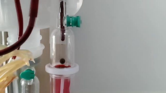 滴管计数器中的红色血滴。