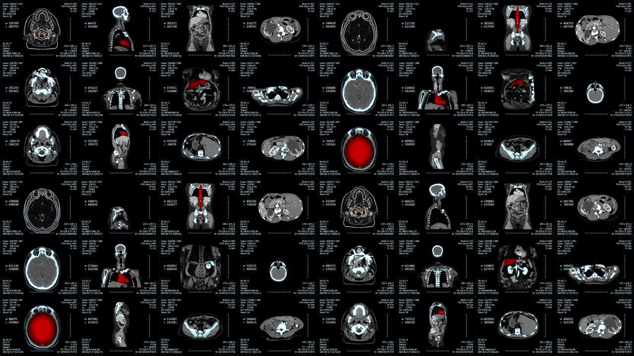 MRI扫描视频墙屏