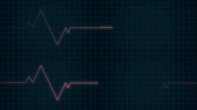 心电图、类型监护仪、医疗概念心电图或心电图医学心脏病学上的红色心跳脉搏节律