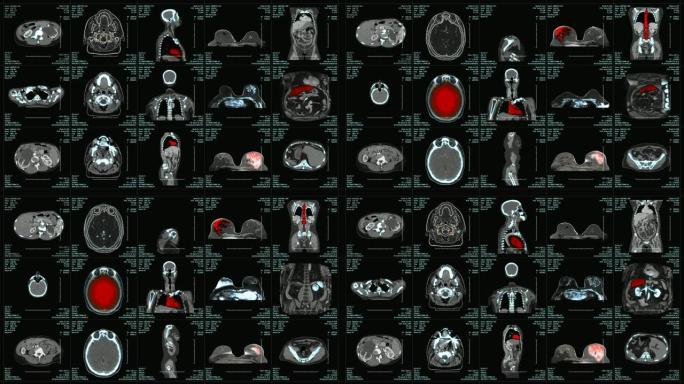 MRI扫描屏幕与额外的医疗数据