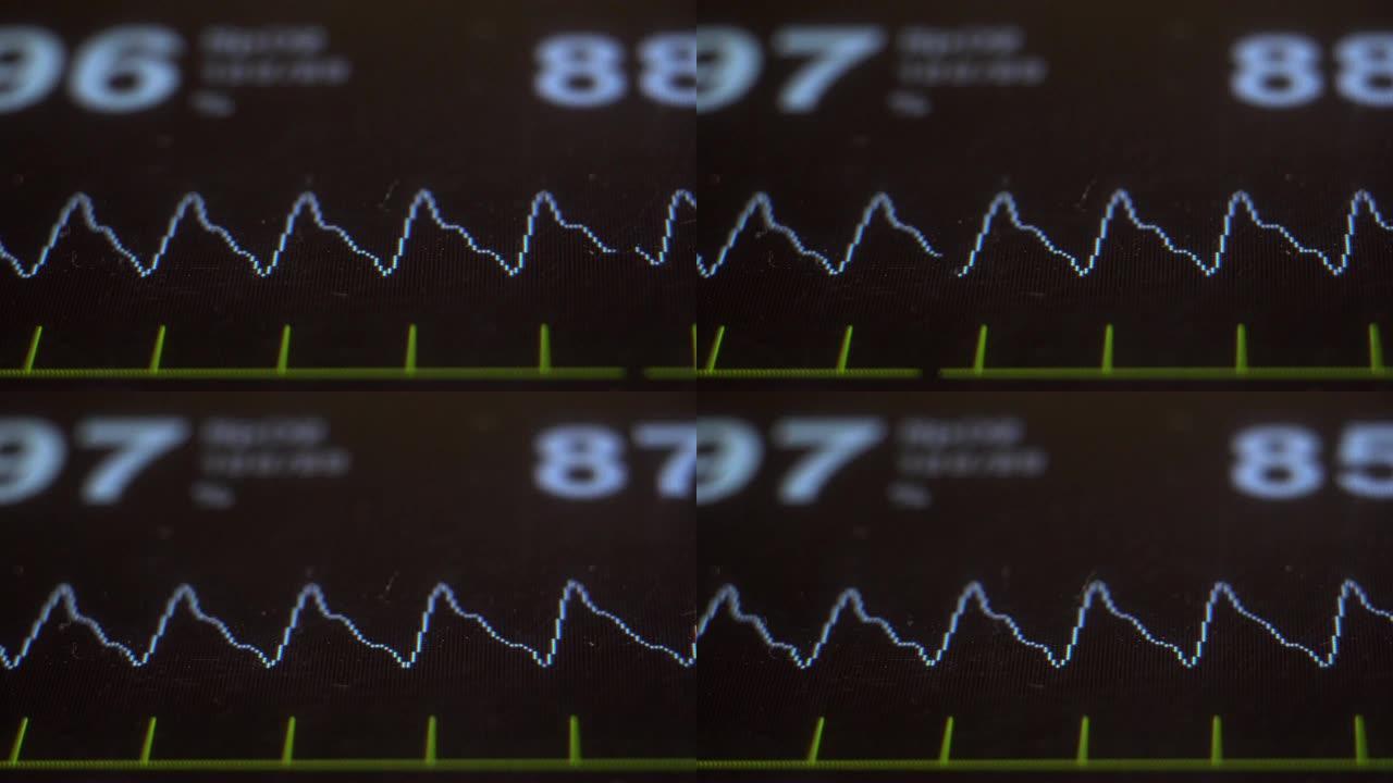 EKG监护仪在医院。血氧饱和度，心率。