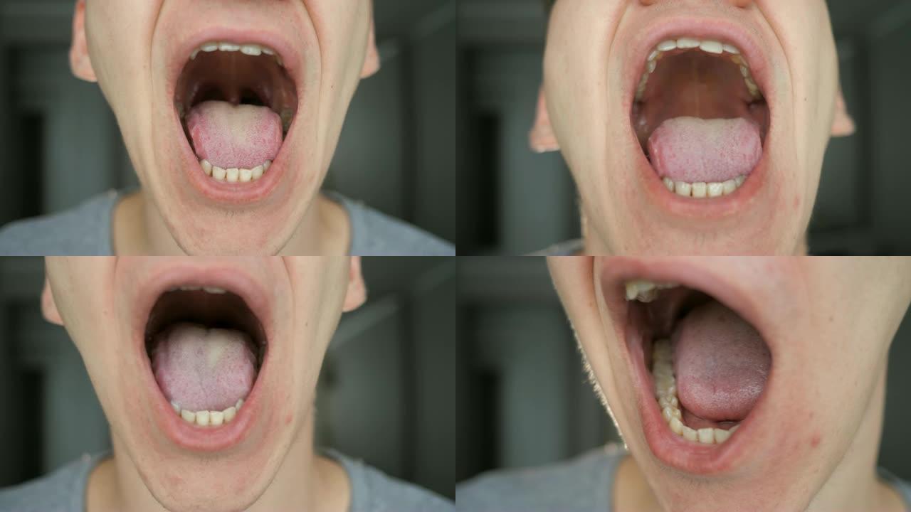 人露出他的嘴、舌头和牙齿。