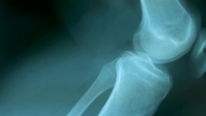 4k x光片用医生的手，多莉拍摄