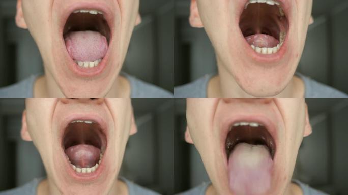 男性口腔和牙齿的特写