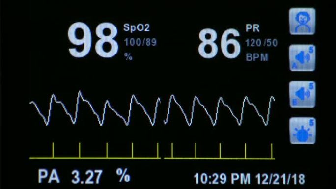 EKG监护仪在医院。血氧饱和度，心率。