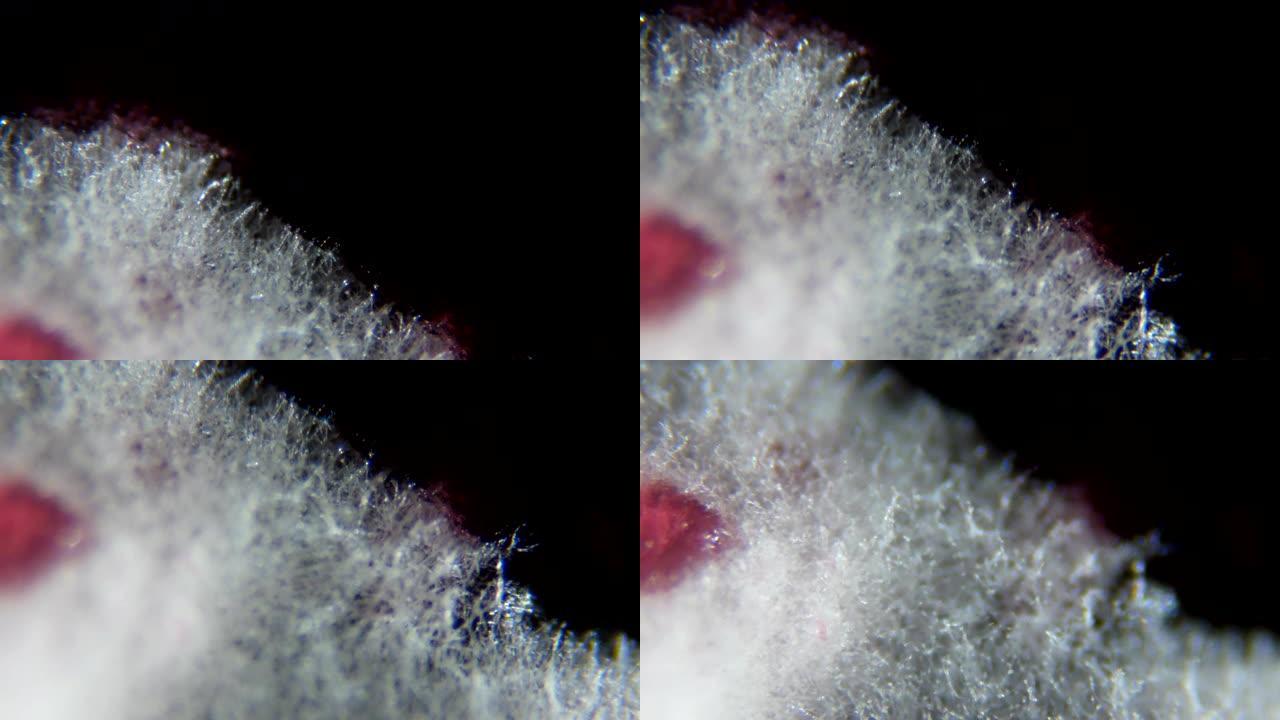 从腐烂的醋栗中取出的霉菌，在显微镜下。浆果果酱上带有孢子的霉菌菌落。过敏，中毒，真菌。白色霉菌菌落的