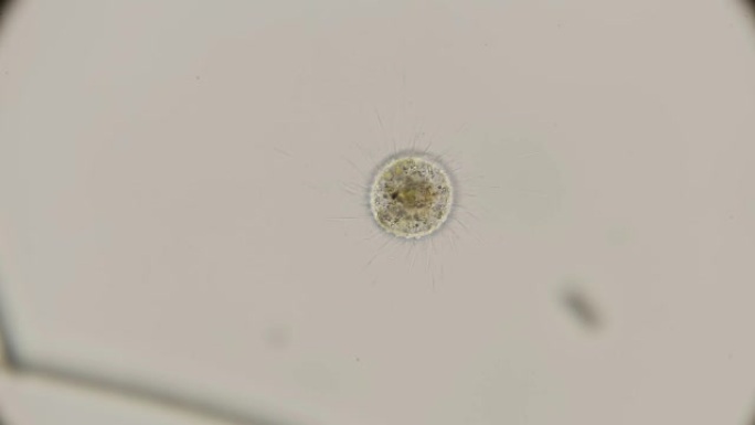 显微镜下的微生物Heliozoa，棘皮细胞