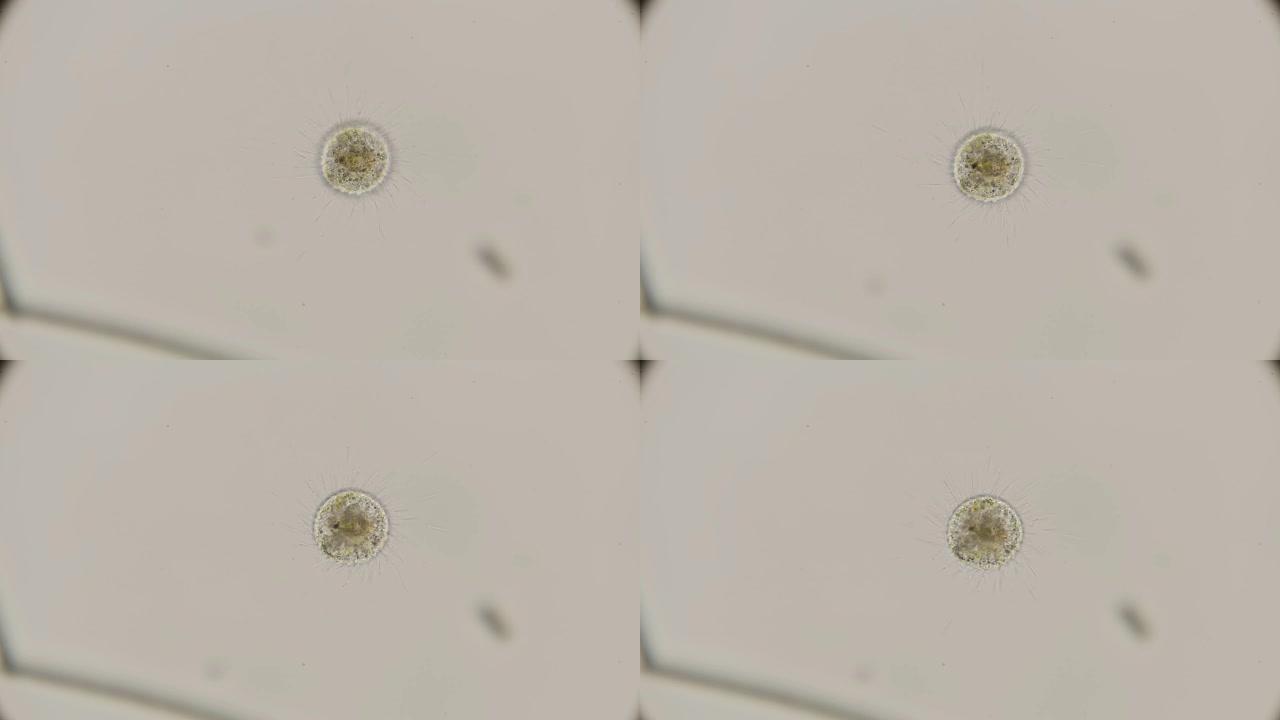 显微镜下的微生物Heliozoa，棘皮细胞