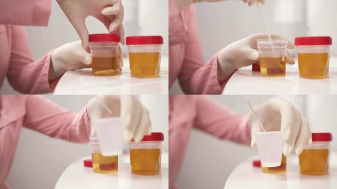 女人的手放在医用乳胶手套中的特写镜头，从容器中取出尿液样本，然后将其从移液管中放入塑料杯中。