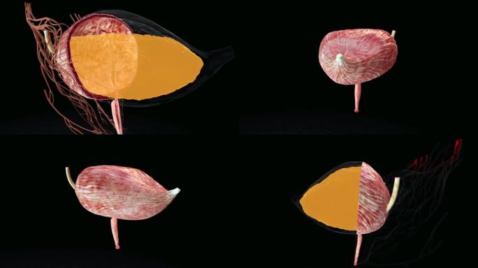 膀胱排尿三维动画