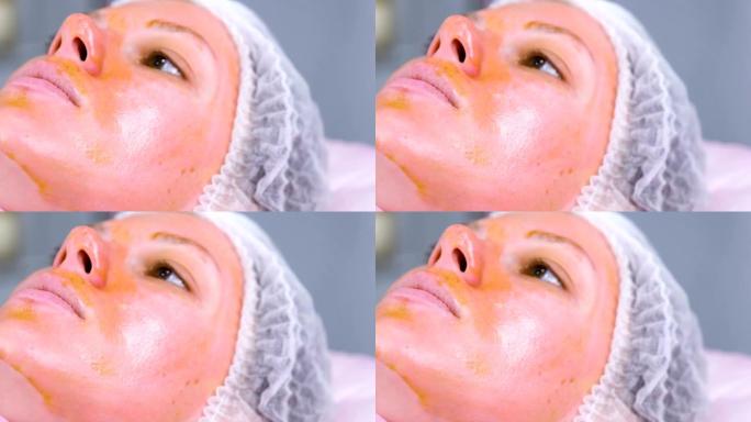 女人脸上的化学剥皮。