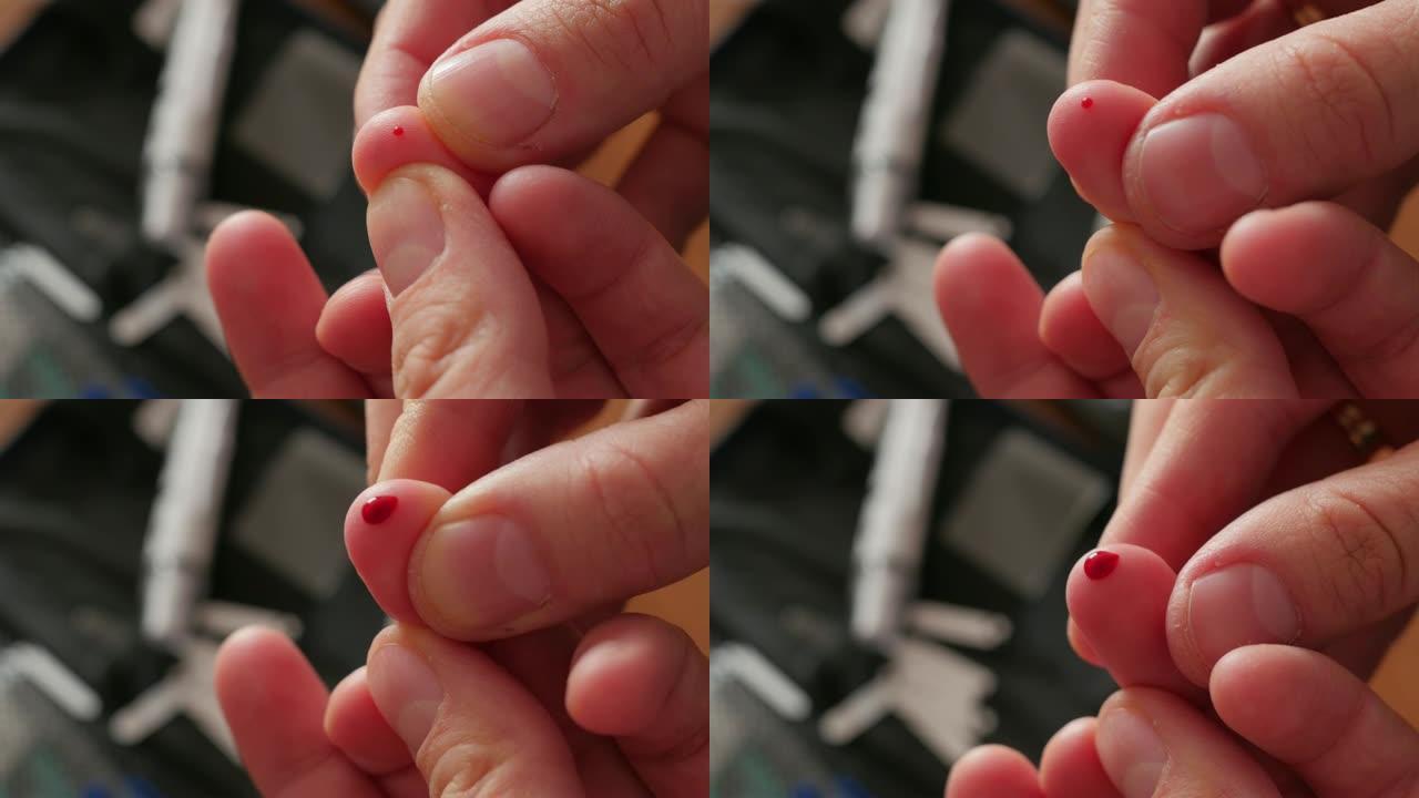 手指刺测血糖，血液