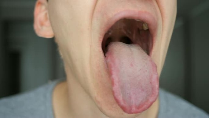 人的特写显示他的嘴，舌头和牙齿