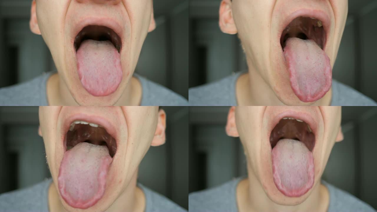 人的特写显示他的嘴，舌头和牙齿