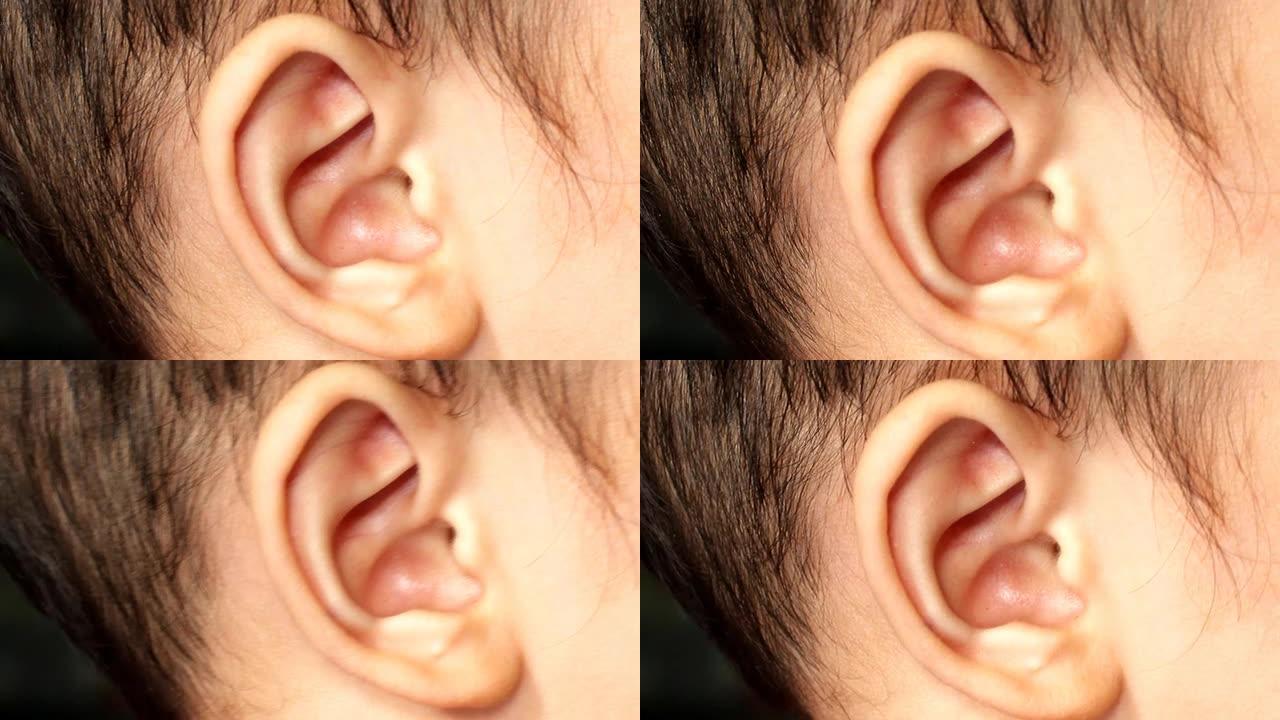 男孩的耳朵