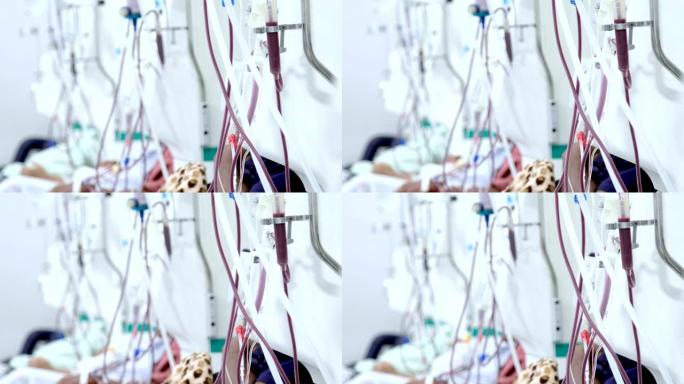 设备上的人进行血液透析