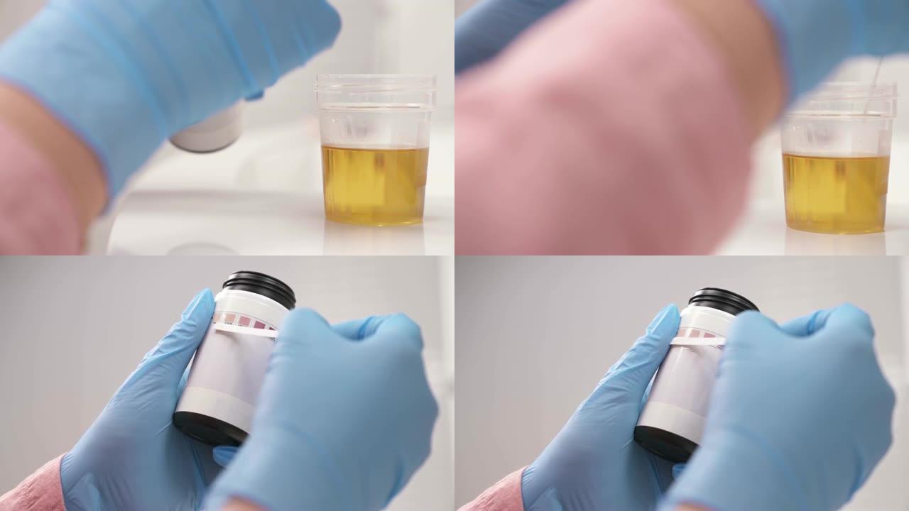 通过使用酮筛查测试条诊断酮尿症的医学实验室科学家的特写镜头