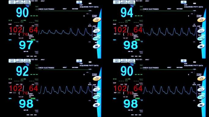 手术室心脏监护仪的特写。心电监护仪显示患者背景的心率
