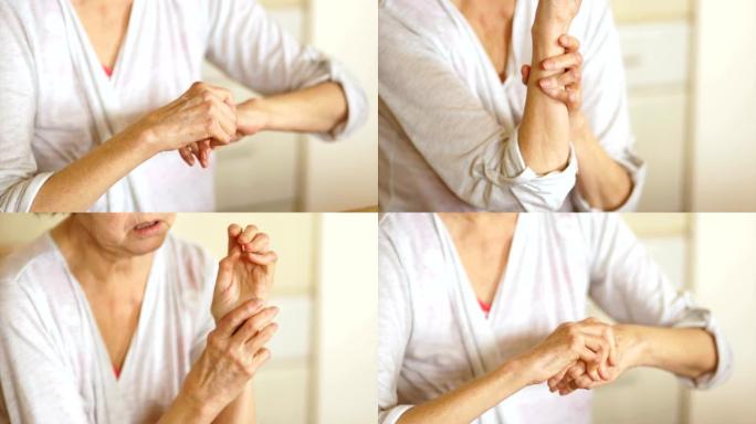 一位患有关节炎的老年妇女的特写镜头用愈合的药膏涂抹了她的手。医学和药理学概念