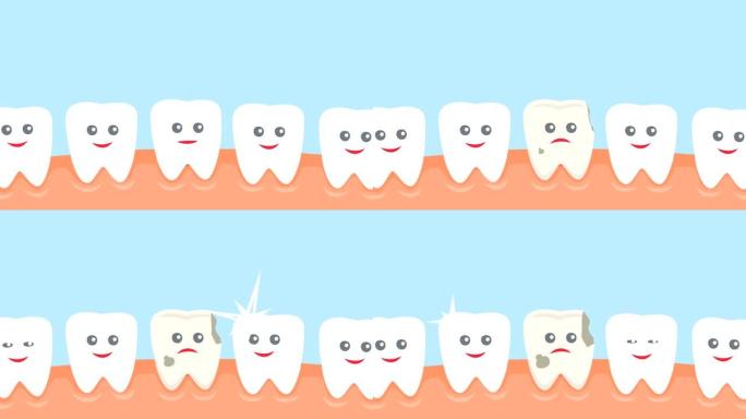 卡通变质坏牙龋齿牙科动画