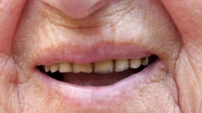 闭上祖母微笑着露出发黄牙齿的嘴。皮肤皱纹的高级女性对着镜头大笑。慢动作