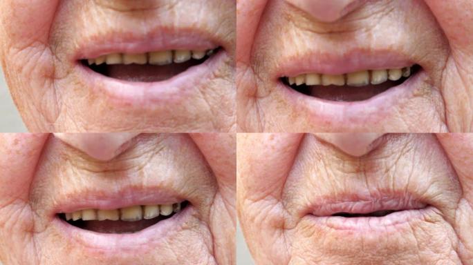 闭上祖母微笑着露出发黄牙齿的嘴。皮肤皱纹的高级女性对着镜头大笑。慢动作