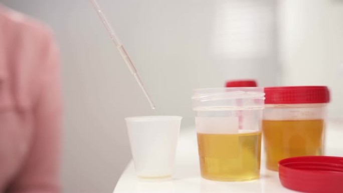 从容器中抽取尿液样本并将其从移液管中放入塑料杯中的演示视频。