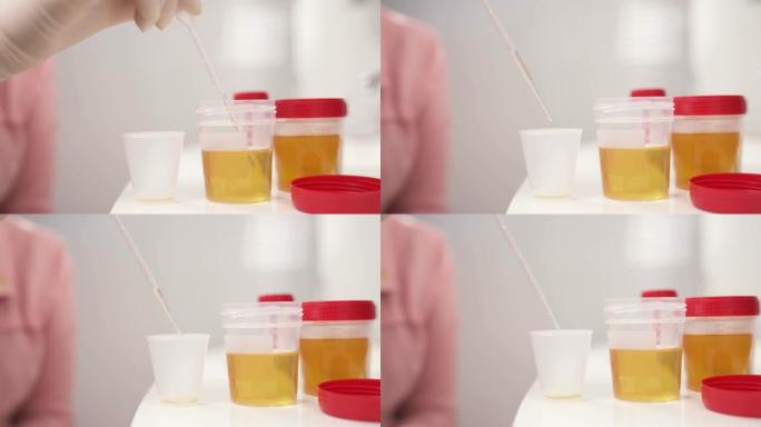 从容器中抽取尿液样本并将其从移液管中放入塑料杯中的演示视频。