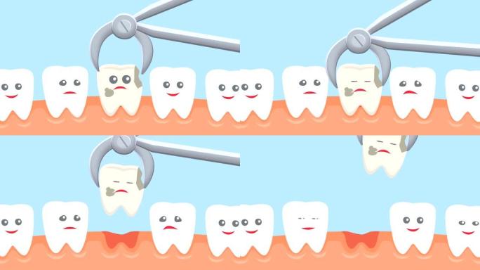 卡通拔牙动画。牙医招待会
