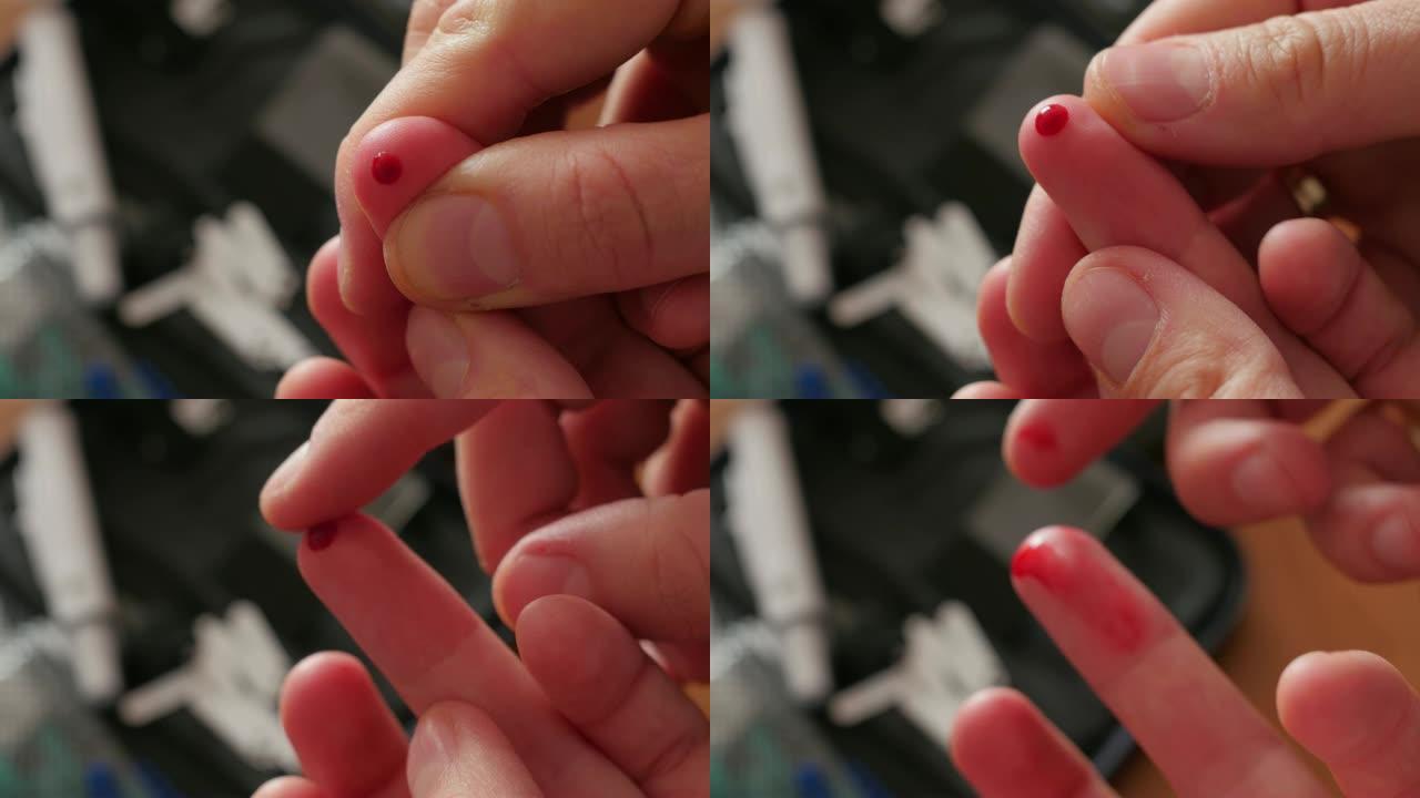 手指刺测血糖，手指涂抹血液