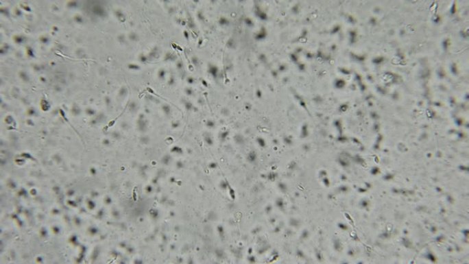 相衬显微镜下的人类精子
