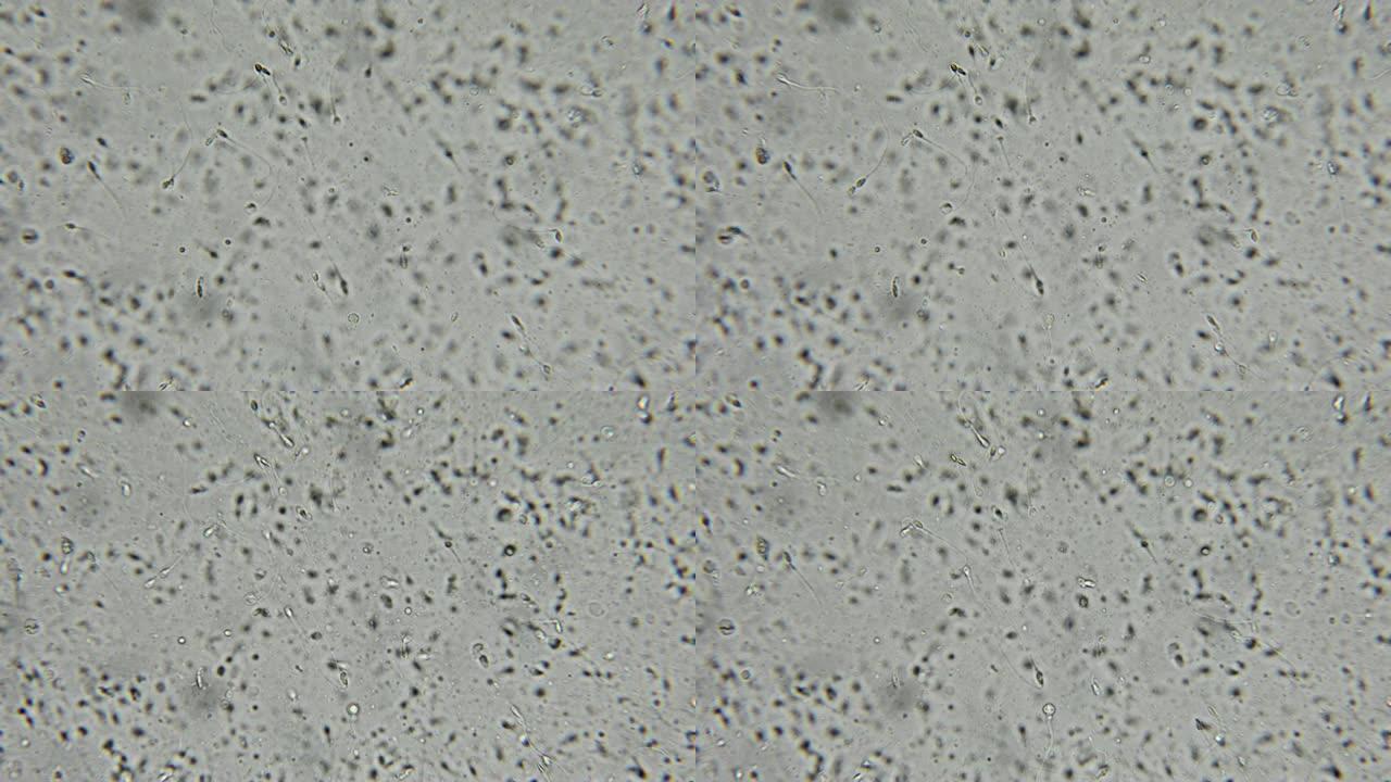 相衬显微镜下的人类精子