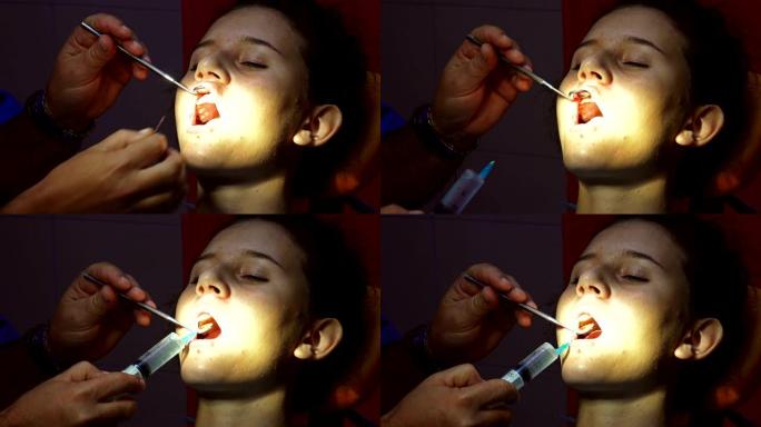 牙科医生用注射器针在口腔手术前消毒牙齿通道