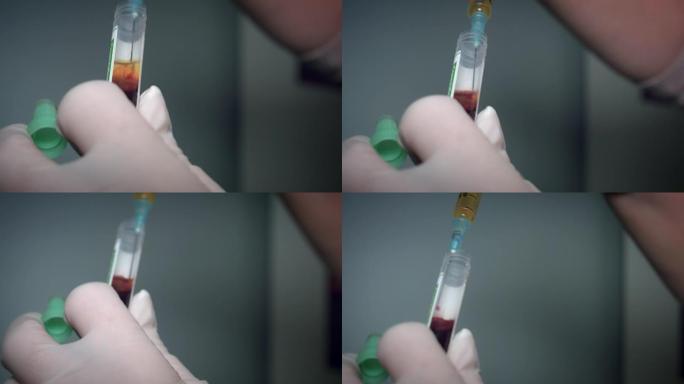 4k特写医生采集血浆用于PRP整容