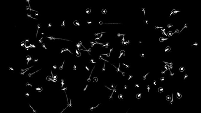 显微镜下检测移动微生物或细菌4K